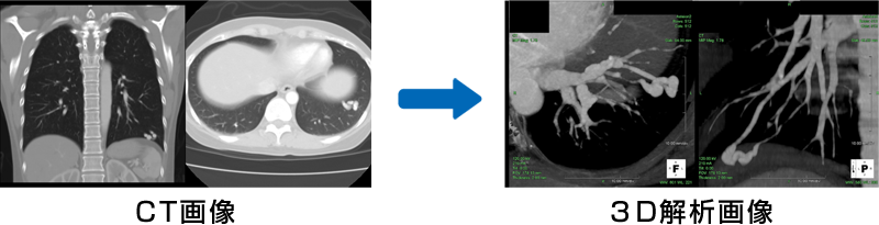 CT画像と3D解析画像